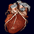 Cardiac CTA Tools3