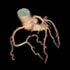 Cardiac CTA Tools2