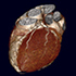 Cardiac CTA Tools4