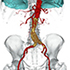Cardiac CTA Tools5