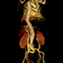 Cardiac CTA Tools8